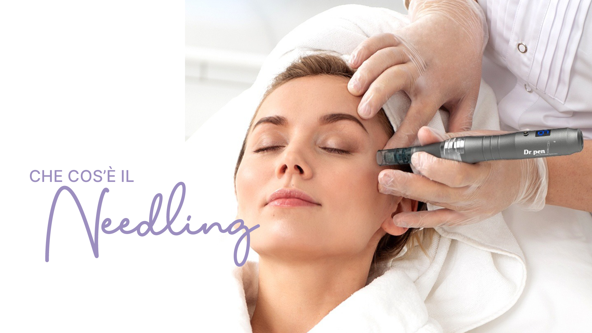 Featured image for “Needling: cos’è e a cosa serve”